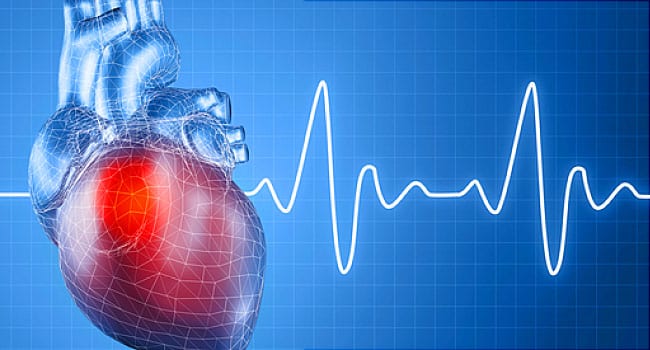 Is Ablation Rx the Best First Choice for A-Fib?