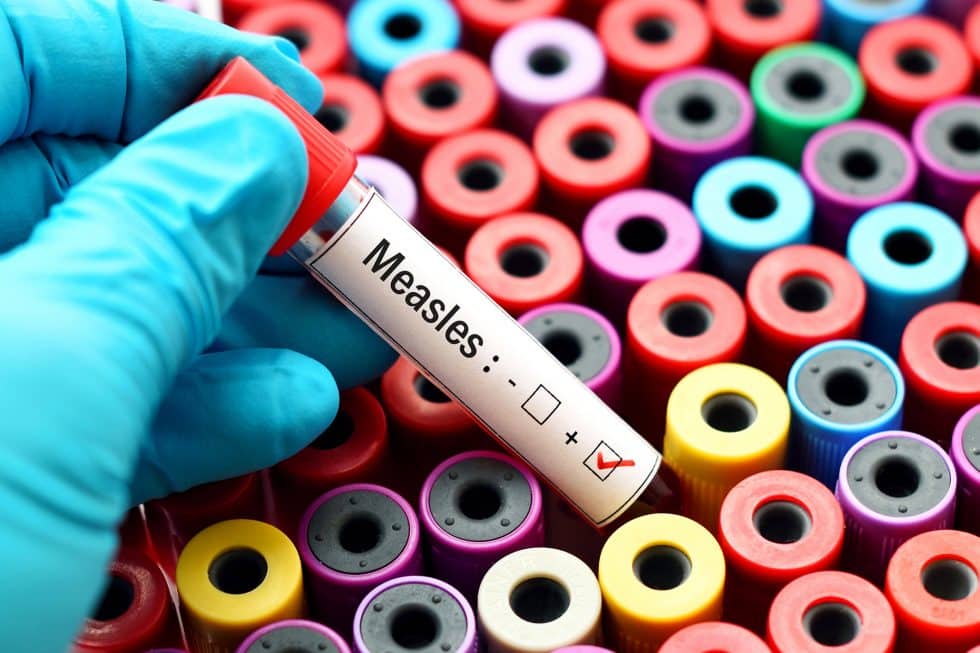 Measles Deaths Grow by Half